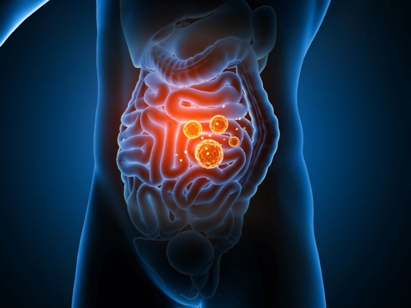 Charlotte Treatment for Leaky Gut – How to Heal Leaky Gut from Companion Health at CompanionHealthNC.com – Charlotte Functional Medicine Charlotte Treatment for Leaky Gut – How to Heal Leaky Gut